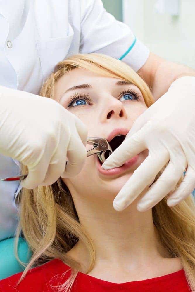 Long Beach dental patient during wisdom teeth removal