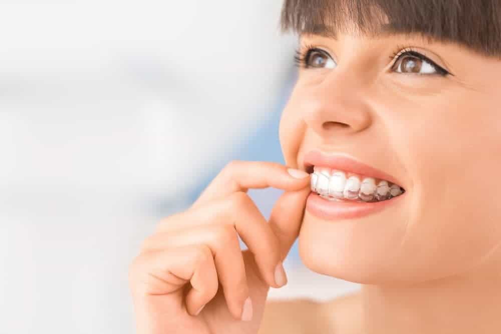 Long Beach dental patient trying invisalign